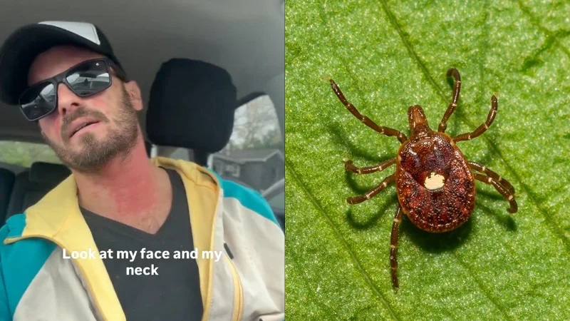 tickbite235