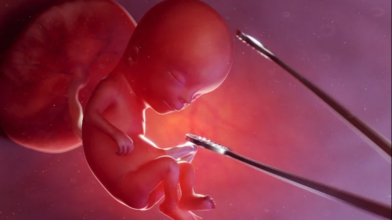 Abortion